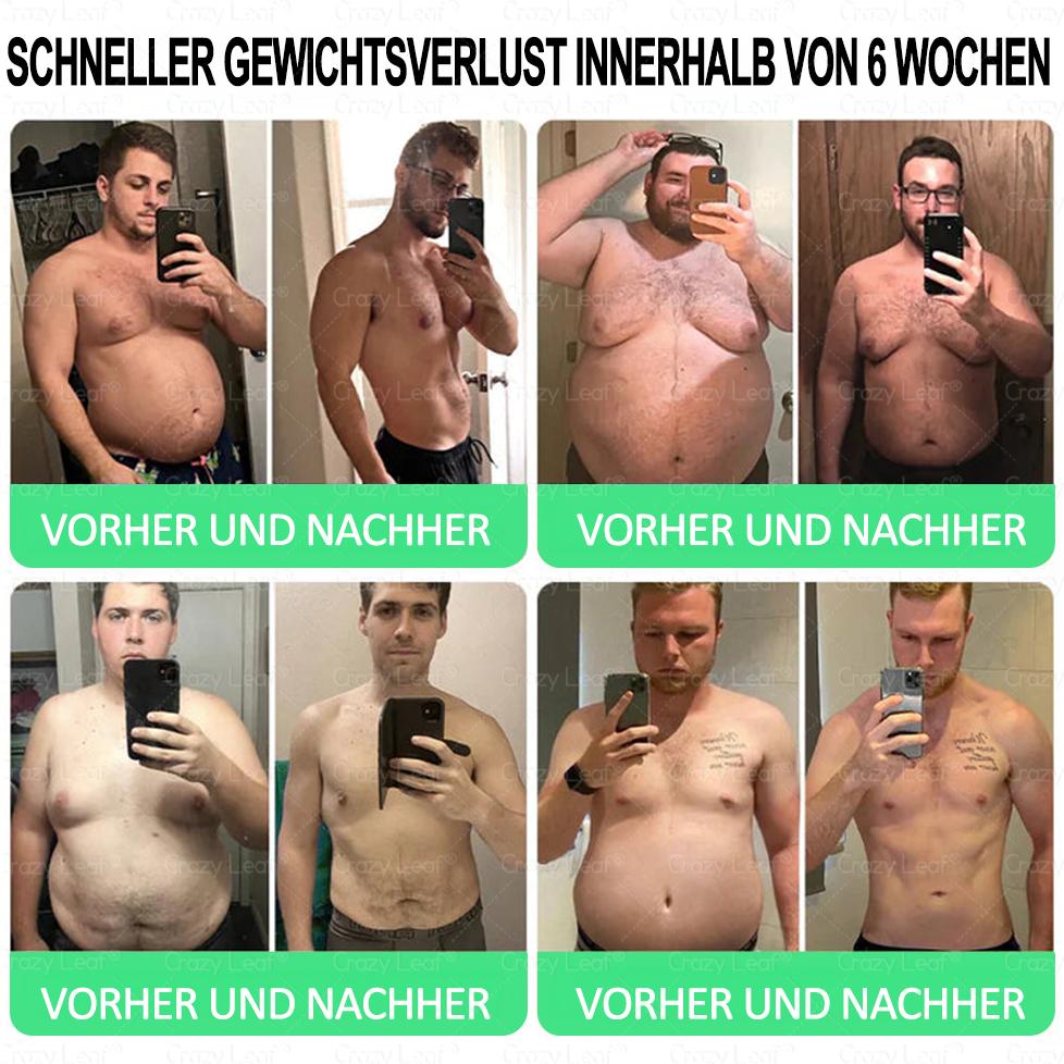 🌈👨⚕️Klinisch bestätigt | Offizieller Shop CrazyLeaf® GLP-1 Trinklösung – wirkt gezielt gegen hartnäckiges Gewicht, Bluthochdruck, Blutzucker, Fettleber, Gelenkschmerzen, Müdigkeit & schlaffe Haut – für mehr Gesundheit & Energie.