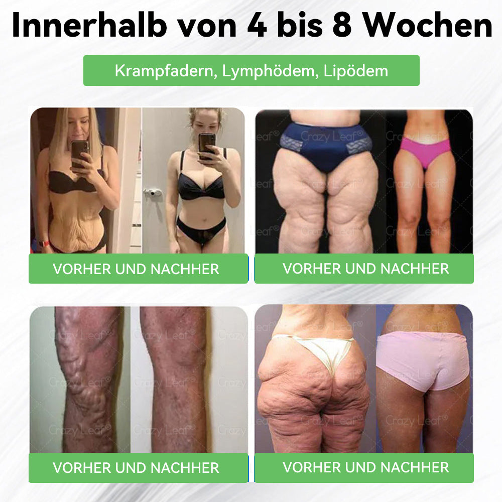 🌈👨⚕️Klinisch bestätigt | Offizieller Shop CrazyLeaf® GLP-1 Trinklösung – wirkt gezielt gegen hartnäckiges Gewicht, Bluthochdruck, Blutzucker, Fettleber, Gelenkschmerzen, Müdigkeit & schlaffe Haut – für mehr Gesundheit & Energie.