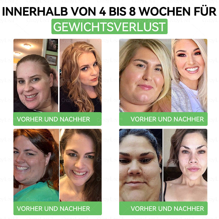 🌈👨⚕️Klinisch bestätigt | Offizieller Shop CrazyLeaf® GLP-1 Trinklösung – wirkt gezielt gegen hartnäckiges Gewicht, Bluthochdruck, Blutzucker, Fettleber, Gelenkschmerzen, Müdigkeit & schlaffe Haut – für mehr Gesundheit & Energie.
