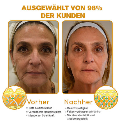 Jetzt jugendliche Haut zurückgewinnen✨ ADNOON® Botox Bienengift Falten- und Fleckencreme