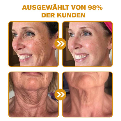 Jetzt jugendliche Haut zurückgewinnen✨ ADNOON® Botox Bienengift Falten- und Fleckencreme